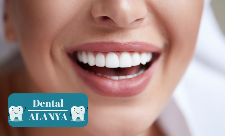 Dental Services in Alanya