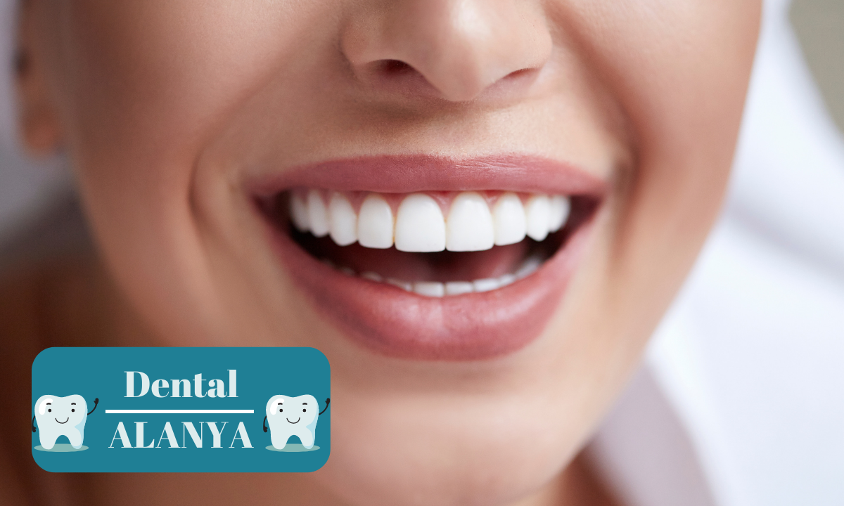 Dental Services In Alanya