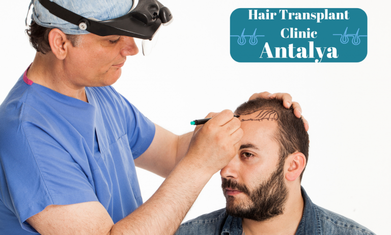 Antalya Hair Transplant Clinic